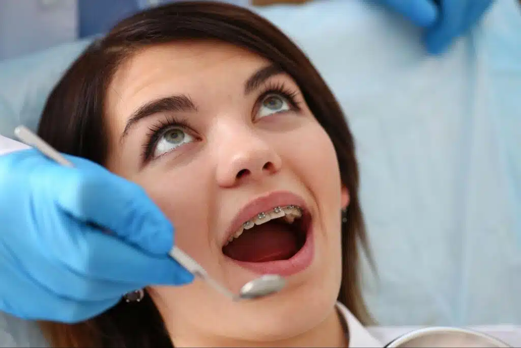 How Do Braces Move Teeth?