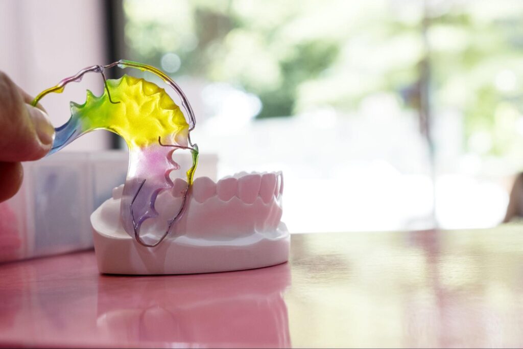 Why is It Important to Use a Retainer After Braces?