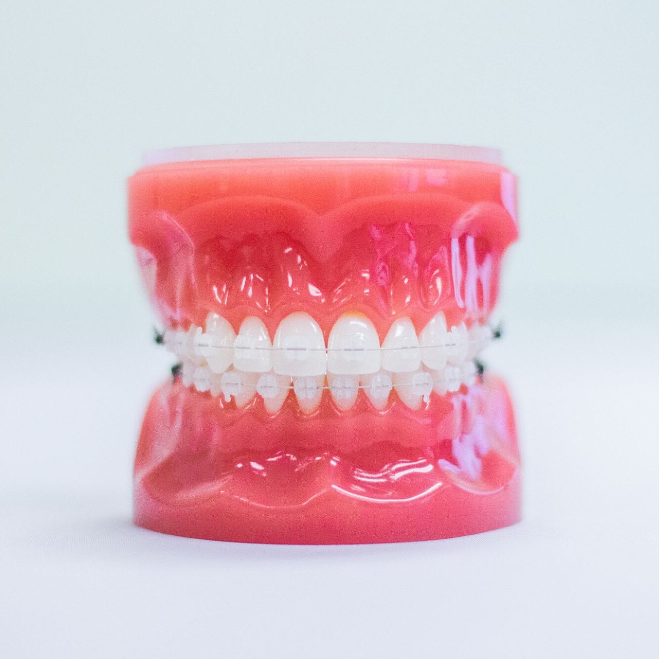clear braces treatment